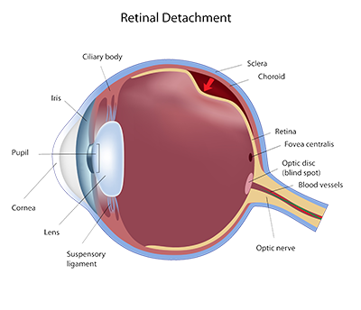 Retinal